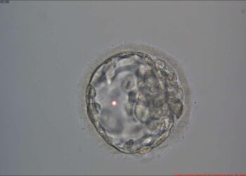 குழந்தையின்மை சிகிச்சை: முறைகள், கால அளவு, செலவு!