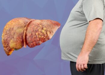 ‘Fatty Liver’ வராமல் தடுக்க என்ன செய்ய வேண்டும்? – கல்லீரலைக் காக்க வாழ்க்கை முறையில் தேவைப்படும் மாற்றங்கள்